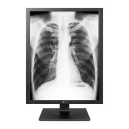 21.3 LG 21HK512D-B IPS 1000CD